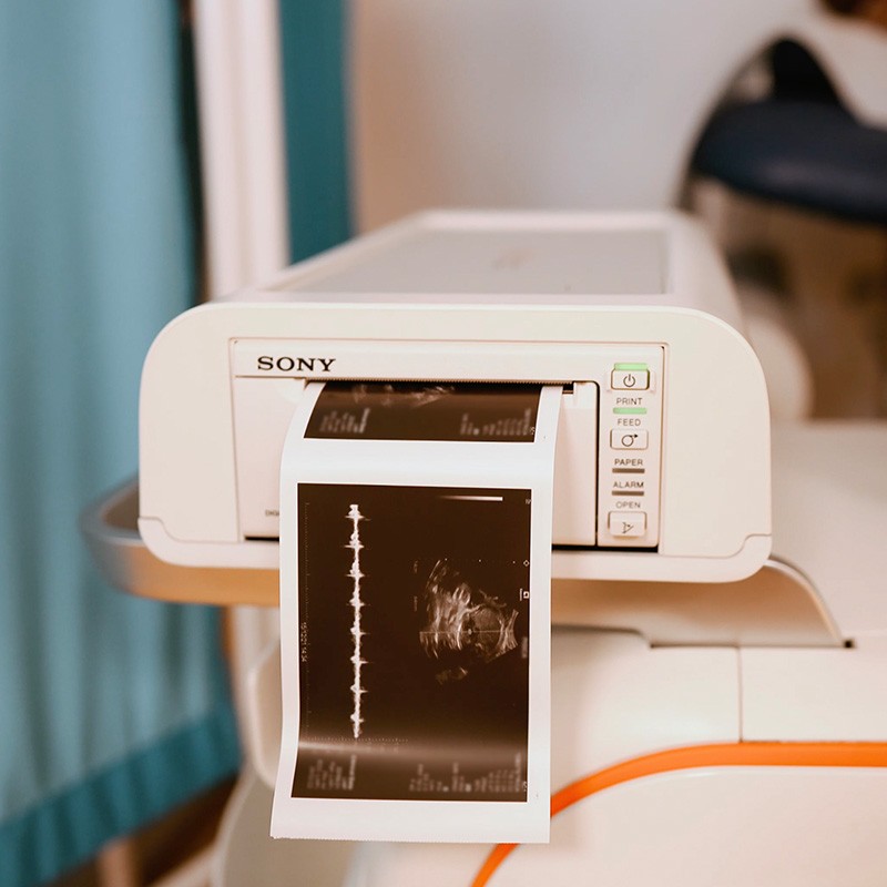 Ecografie de sarcină